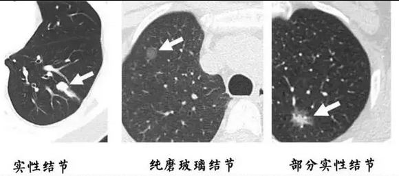 from clipboard from clipboard